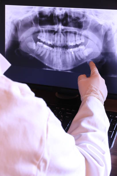 Best Emergency Tooth Extraction in Gordo, AL